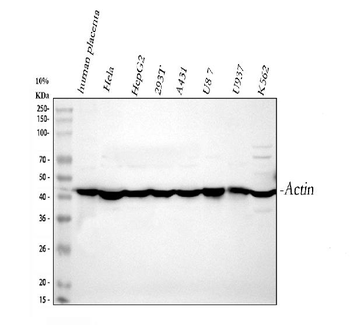 Anti-Actin/ACTA1 Antibody