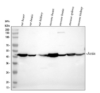 Anti-Actin/ACTA1 Antibody