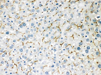 Anti-ABCB11 Antibody