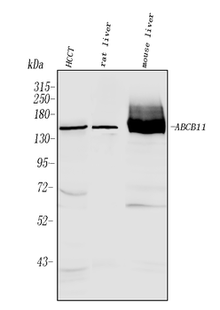 Anti-ABCB11 Antibody