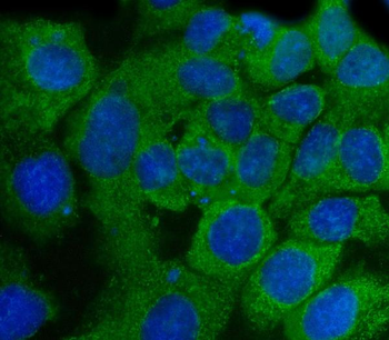 Anti-SSH3BP1/ABI1 Antibody