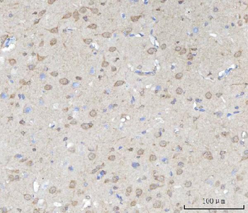 Anti-SSH3BP1/ABI1 Antibody