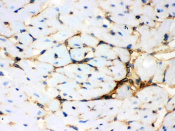 Anti-Annexin A3/ANXA3 Antibody