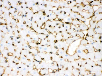 Anti-Annexin A3/ANXA3 Antibody