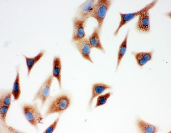 Anti-Annexin A3/ANXA3 Antibody