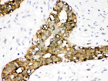 Anti-Annexin A3/ANXA3 Antibody