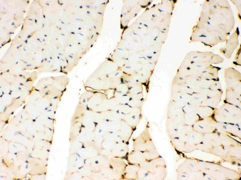Anti-Annexin A3/ANXA3 Antibody
