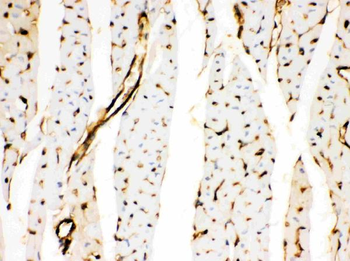 Anti-Annexin A3/ANXA3 Antibody
