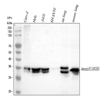 Anti-Annexin A3/ANXA3 Antibody