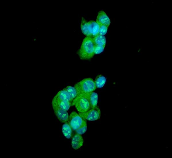 Anti-Ataxin 1/ATXN1 Antibody