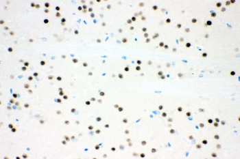 Anti-Ataxin 1/ATXN1 Antibody