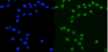 Anti-Ataxin 3/ATXN3 Antibody