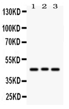 Anti-Ataxin 3/ATXN3 Antibody