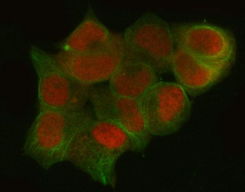 Anti-CtBP1 Antibody