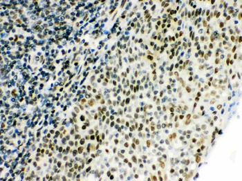 Anti-CtBP1 Antibody