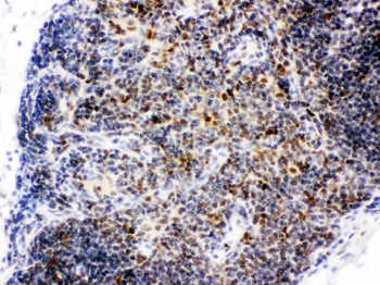 Anti-CtBP1 Antibody