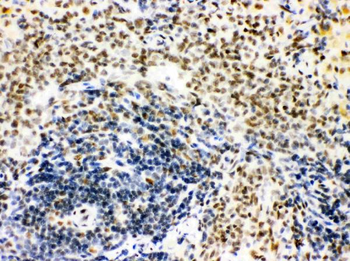 Anti-CtBP1 Antibody