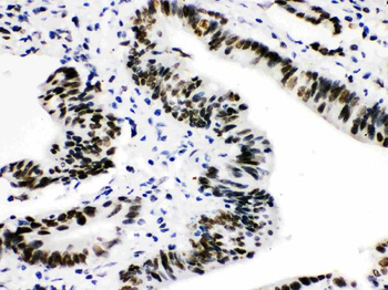 Anti-CTBP2 Antibody