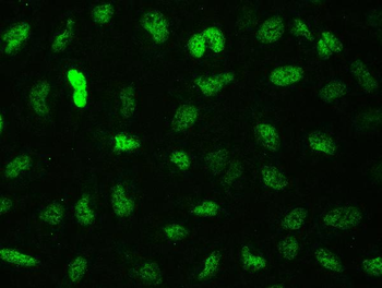 Anti-CTBP2 Antibody