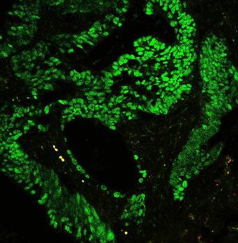 Anti-CTBP2 Antibody