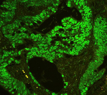 Anti-CTBP2 Antibody