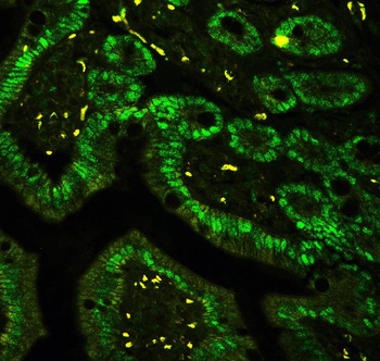 Anti-CTBP2 Antibody