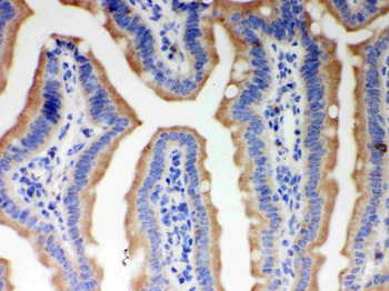 Anti-ITPR3 Antibody