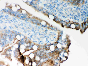Anti-ITPR3 Antibody