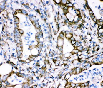 Anti-Plectin Antibody