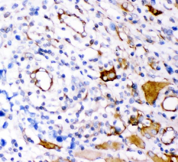 Anti-Plectin Antibody