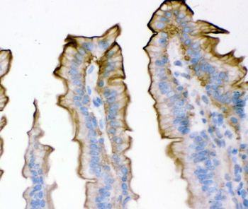 Anti-Plectin Antibody