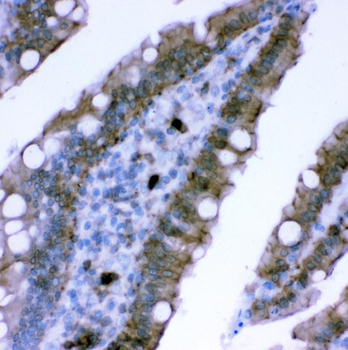 Anti-Plectin Antibody
