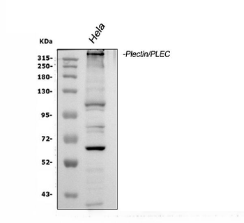 Anti-Plectin Antibody