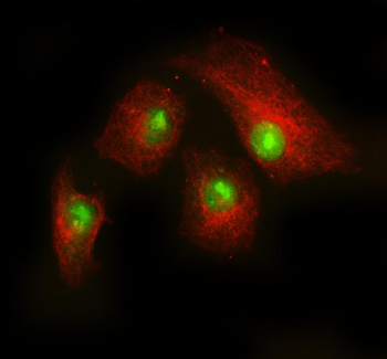 Anti-Rac1 Antibody