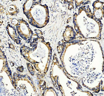 Anti-Rac1 Antibody