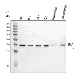 Anti-Rac1 Antibody