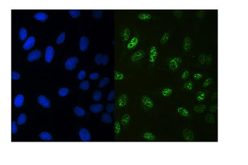 Anti-RUNX3 Antibody