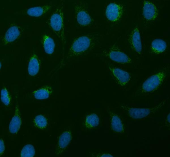 Anti-SDHA Antibody