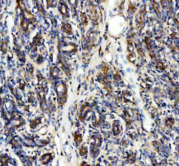 Anti-SDHA Antibody