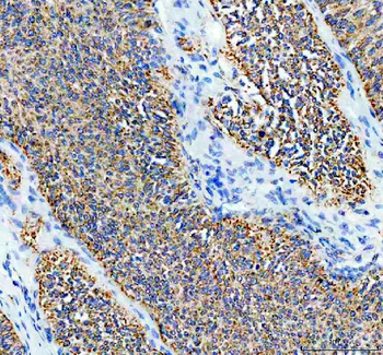 Anti-SDHA Antibody