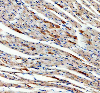 Anti-SDHA Antibody