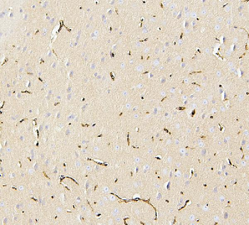Anti-Glucose Transporter GLUT1/SLC2A1 Antibody