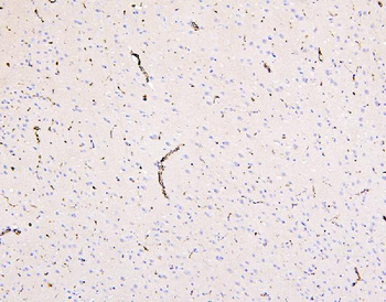 Anti-Glucose Transporter GLUT1/SLC2A1 Antibody