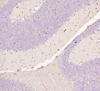 Anti-Glucose Transporter GLUT1/SLC2A1 Antibody