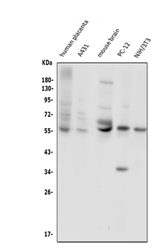 Anti-Glucose Transporter GLUT1/SLC2A1 Antibody