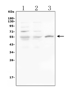 Anti-Glucose Transporter GLUT1/SLC2A1 Antibody