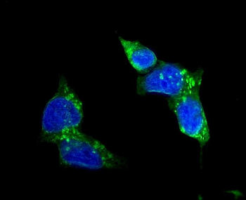 Anti-Glucose Transporter GLUT1/SLC2A1 Antibody