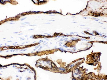 Anti-Glucose Transporter GLUT1/SLC2A1 Antibody