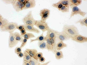 Anti-Glucose Transporter GLUT1/SLC2A1 Antibody