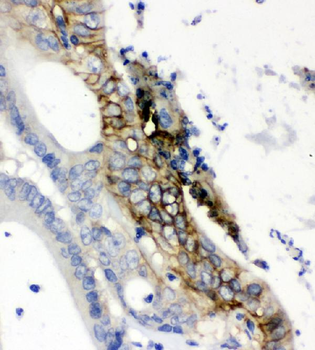 Anti-Glucose Transporter GLUT1/SLC2A1 Antibody